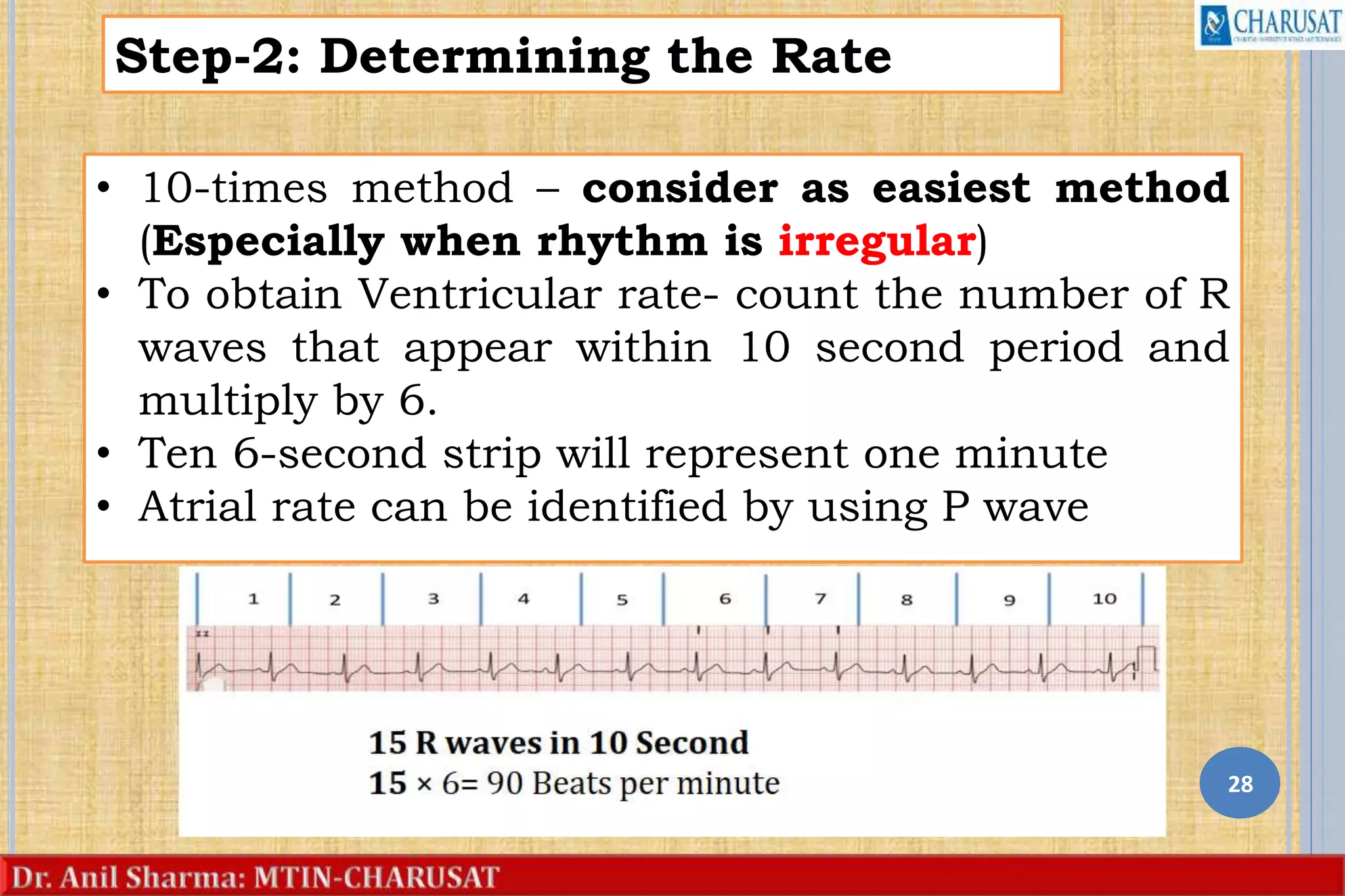 28
Step-2: Determining the Rate
• 10-times method – consider as easiest method
(Especially when rhythm is irregular)
• To obtain Ventricular rate- count the number of R
waves that appear within 10 second period and
multiply by 6.
• Ten 6-second strip will represent one minute
• Atrial rate can be identified by using P wave
 