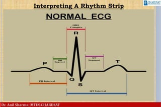 Basic of ecg interpretation | PPTX