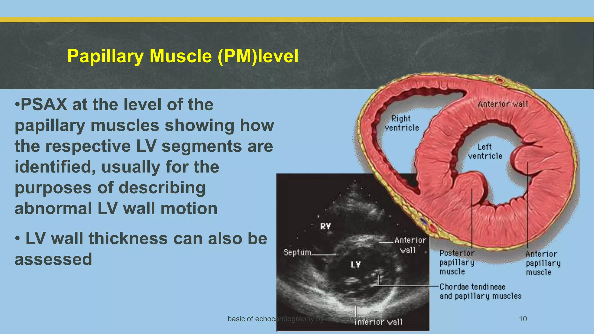 Echocardiography basics | PPTX
