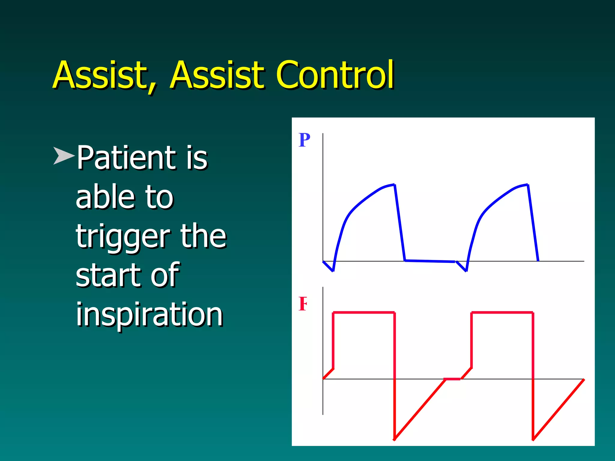 Assist, Assist Control Patient is able to trigger the start of inspiration F P 