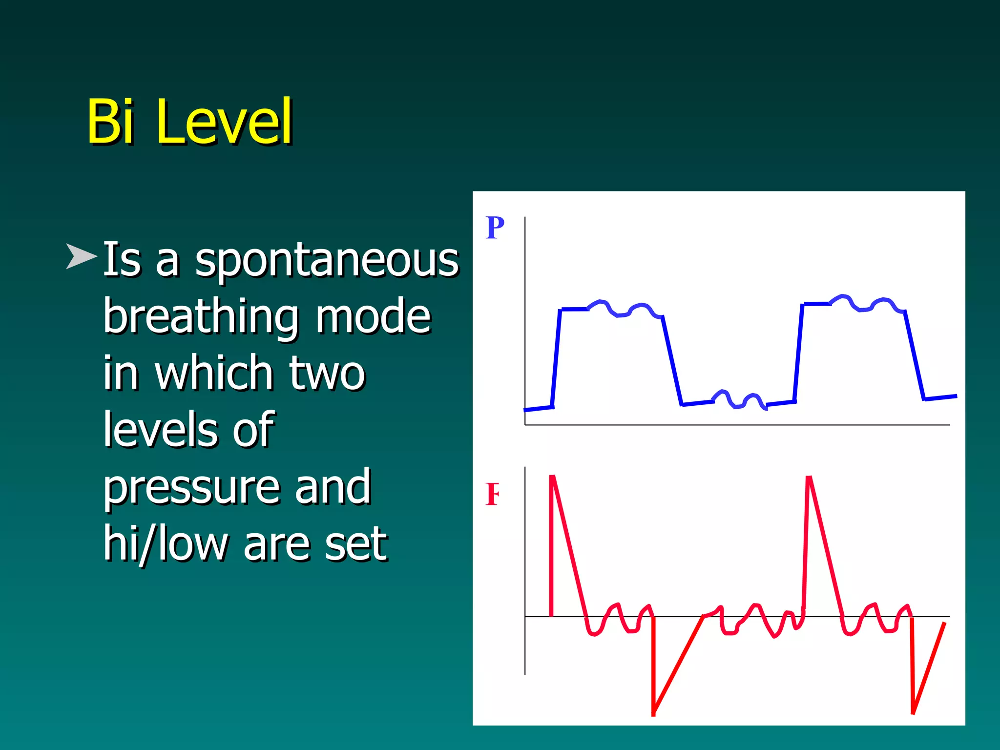 Bi Level Is a spontaneous breathing mode in which two levels of pressure and hi/low are set F P 