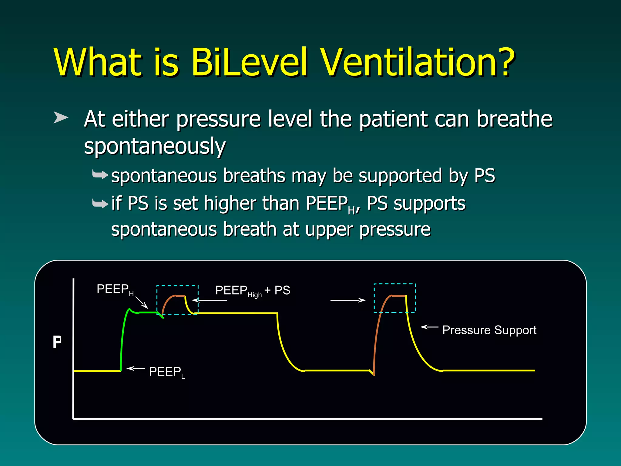 What is BiLevel Ventilation? At either pressure level the patient can breathe spontaneously spontaneous breaths may be supported by PS  if PS is set higher than PEEP H , PS supports spontaneous breath at upper pressure  T PEEP High  + PS  P PEEP L PEEP H Pressure Support 