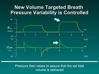 Pressure then raises to assure that the set tidal volume is delivered New Volume Targeted Breath  Pressure Variability is Controlled 