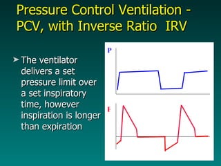 Pressure Control Ventilation - PCV, with Inverse Ratio  IRV The ventilator delivers a set pressure limit over a set inspiratory time, however inspiration is longer than expiration F P 
