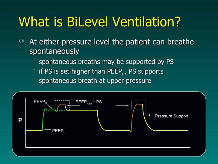 Basic Of Mechanical Ventilation