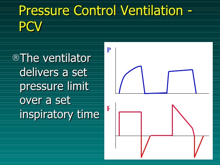 Basic Of Mechanical Ventilation