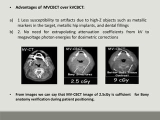 • Advantages of MVCBCT over kVCBCT:
a) 1 Less susceptibility to artifacts due to high-Z objects such as metallic
markers in the target, metallic hip implants, and dental fillings
b) 2. No need for extrapolating attenuation coefficients from kV to
megavoltage photon energies for dosimetric corrections
• From images we can say that MV-CBCT image of 2.5cGy is sufficient
anatomy verification during patient positioning.
for Bony
 