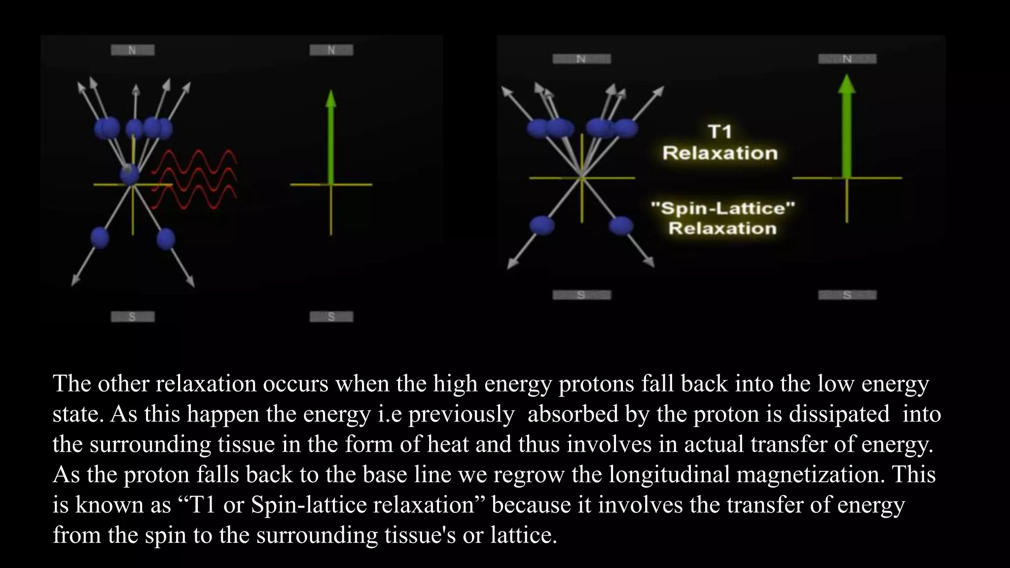 The other relaxation occurs when the high energy protons fall back into the low energy
state. As this happen the energy i.e previously absorbed by the proton is dissipated into
the surrounding tissue in the form of heat and thus involves in actual transfer of energy.
As the proton falls back to the base line we regrow the longitudinal magnetization. This
is known as “T1 or Spin-lattice relaxation” because it involves the transfer of energy
from the spin to the surrounding tissue's or lattice.
 