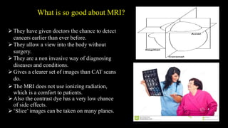 What is so good about MRI?
They have given doctors the chance to detect
cancers earlier than ever before.
They allow a view into the body without
surgery.
They are a non invasive way of diagnosing
diseases and conditions.
Gives a clearer set of images than CAT scans
do.
The MRI does not use ionizing radiation,
which is a comfort to patients.
Also the contrast dye has a very low chance
of side effects.
‘Slice’ images can be taken on many planes.
 