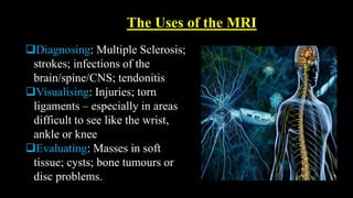The Uses of the MRI
Diagnosing: Multiple Sclerosis;
strokes; infections of the
brain/spine/CNS; tendonitis
Visualising: Injuries; torn
ligaments – especially in areas
difficult to see like the wrist,
ankle or knee
Evaluating: Masses in soft
tissue; cysts; bone tumours or
disc problems.
 