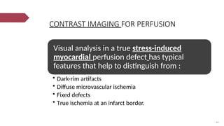 Fixed Defect BASIC OF MRI cardiac magnetic resonance imaging.pptx