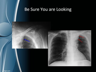 Basic of radiology | PPT