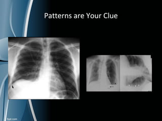 Basic of radiology | PPT