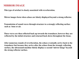 MIRROR IMAGE
This type of artefact is closely associated with reverberation.
Mirror images form when echoes are falsely displayed beyond a strong reflector.
Transmission of sound waves through structure to a strongly reflecting surface
such as bone or air.
These waves are then reflected back up towards the transducer, however they are
reflected by the initial structure and returned back down throughout the tissue.
After numerous rounds of reverberation, the echoes eventually arrive back to the
transducer but because they arrive after the echoes from the strongly reflecting
surface, the ultrasound machine falsely displays a second ‘mirror image’ beyond
the strong reflector surface.
 