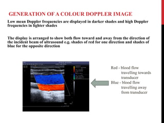 GENERATION OF A COLOUR DOPPLER IMAGE
Low mean Doppler frequencies are displayed in darker shades and high Doppler
frequencies in lighter shades
The display is arranged to show both flow toward and away from the direction of
the incident beam of ultrasound e.g. shades of red for one direction and shades of
blue for the opposite direction
Red - blood flow
travelling towards
transducer
Blue - blood flow
travelling away
from transducer
 
