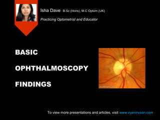 BASIC
OPHTHALMOSCOPY
FINDINGS
Isha Dave B.Sc (Hons), M.C Optom (UK)
Practicing Optometrist and Educator
To view more presentations and articles, visit www.eyenirvaan.com
 