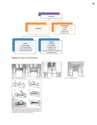 Basic Oral Implantology for General Dental Practitioners (June 9, 2024).pdf