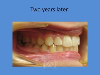 Tooth Later BASIC_ORTHODONTICS.pdf