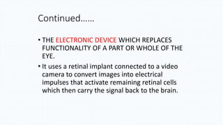 • THE ELECTRONIC DEVICE WHICH REPLACES
FUNCTIONALITY OF A PART OR WHOLE OF THE
EYE.
• It uses a retinal implant connected to a video
camera to convert images into electrical
impulses that activate remaining retinal cells
which then carry the signal back to the brain.
Continued……
 