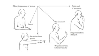 Basic overview on Movement Disorders.pptx