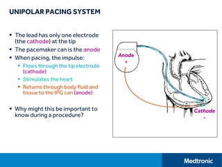 UNIPOLAR PACING SYSTEM
 The lead has only one electrode
(the cathode) at the tip
 The pacemaker can is the anode
 When pacing, the impulse:
 Flows through the tip electrode
(cathode)
 Stimulates the heart
 Returns through body fluid and
tissue to the IPG can (anode)
 Why might this be important to
know during a procedure?
Cathode
-
Anode
+
 