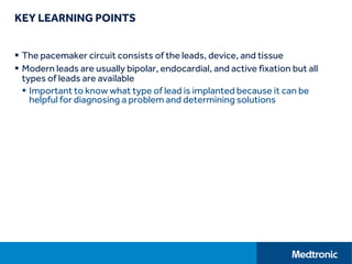 KEY LEARNING POINTS
 The pacemaker circuit consists of the leads, device, and tissue
 Modern leads are usually bipolar, endocardial, and active fixation but all
types of leads are available
 Important to know what type of lead is implanted because it can be
helpful for diagnosing a problem and determining solutions
 