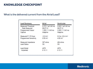 KNOWLEDGE CHECKPOINT
What is the delivered current from the Atrial Lead?
 