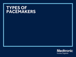 TYPES OF
PACEMAKERS
 