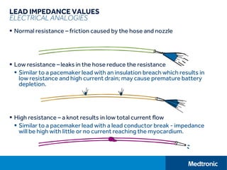 LEAD IMPEDANCE VALUES
ELECTRICAL ANALOGIES
 Normal resistance – friction caused by the hose and nozzle
 Low resistance –leaks in the hose reduce the resistance
 Similar to a pacemaker lead with an insulation breach which results in
low resistance and high current drain; may cause premature battery
depletion.
 High resistance – a knot results in low total current flow
 Similar to a pacemaker lead with a lead conductor break - impedance
will be high with little or no current reaching the myocardium.
 