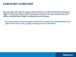 CASE STUDY: CLINIC VISIT
85 year old male with h/o pacemaker implant in 1996. Generator change in
2005. Follow up visits in clinic have been normal. He now comes into your
office complaining of light-headedness and fatigue.
You interrogate his pacemaker and find the ventricular lead impedance is
1,867 ohms and it was usually trending around 700 ohms.
 