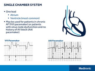 SINGLE CHAMBER SYSTEM
 One lead
 Atrium
 Ventricle (most common)
 May be used for patients in chronic
AF (VVI pacemaker) or patients
with sinus node dysfunction and no
history of AV block (AAI
pacemaker)
VVI Pacemaker AAI Pacemaker
 