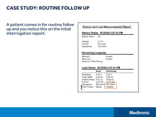 CASE STUDY: ROUTINE FOLLOW UP
A patient comes in for routine follow
up and you notice this on the initial
interrogation report:
 