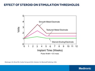 EFFECT OF STEROID ON STIMULATION THRESHOLDS
Ellenbogen, KA, Wood MA. Cardiac Pacing and ICDs. Hoboken, NJ: Blackwell Publishing; 1996.
 
