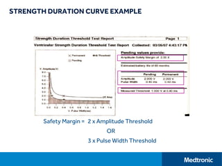 STRENGTH DURATION CURVE EXAMPLE
Safety Margin = 2 x Amplitude Threshold
OR
3 x Pulse Width Threshold
 