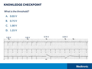 KNOWLEDGE CHECKPOINT
What is the threshold?
A. 0.05 V
B. 0.75 V
C. 1.00 V
D. 1.25 V
1.25 V 0.05 V0.75 V1.00 V
 