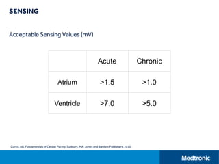 SENSING
Acceptable Sensing Values (mV)
Curtis, AB. Fundamentalsof Cardiac Pacing. Sudbury, MA: Jones and Bartlett Publishers; 2010.
 