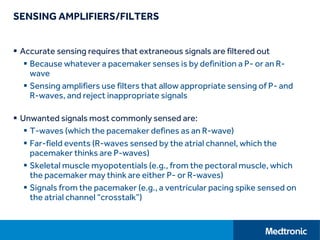 SENSING AMPLIFIERS/FILTERS
 Accurate sensing requires that extraneous signals are filtered out
 Because whatever a pacemaker senses is by definition a P- or an R-
wave
 Sensing amplifiers use filters that allow appropriate sensing of P- and
R-waves, and reject inappropriate signals
 Unwanted signals most commonly sensed are:
 T-waves (which the pacemaker defines as an R-wave)
 Far-field events (R-waves sensed by the atrial channel, which the
pacemaker thinks are P-waves)
 Skeletal muscle myopotentials (e.g., from the pectoral muscle, which
the pacemaker may think are either P- or R-waves)
 Signals from the pacemaker (e.g., a ventricular pacing spike sensed on
the atrial channel “crosstalk”)
 