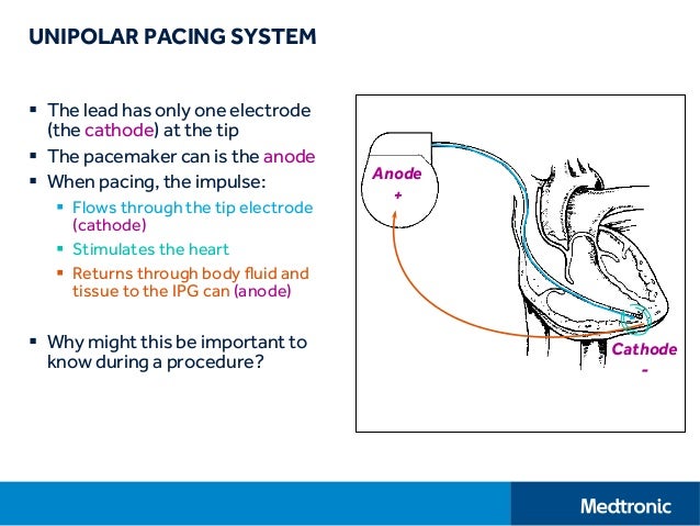 basic pacing concepts