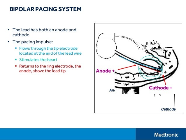 basic pacing concepts