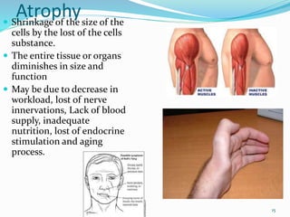 basic pathology.pdf