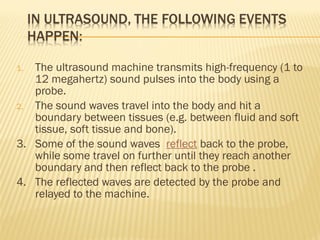 1. The ultrasound machine transmits high-frequency (1 to
12 megahertz) sound pulses into the body using a
probe.
2. The so...