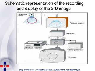 Schematic representation of the recording and display of the 2-D image   