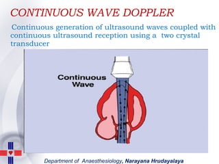 CONTINUOUS WAVE DOPPLER <ul><li>Continuous generation of ultrasound waves coupled with continuous ultrasound reception usi...