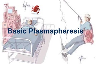 1
Basic Plasmapheresis
 