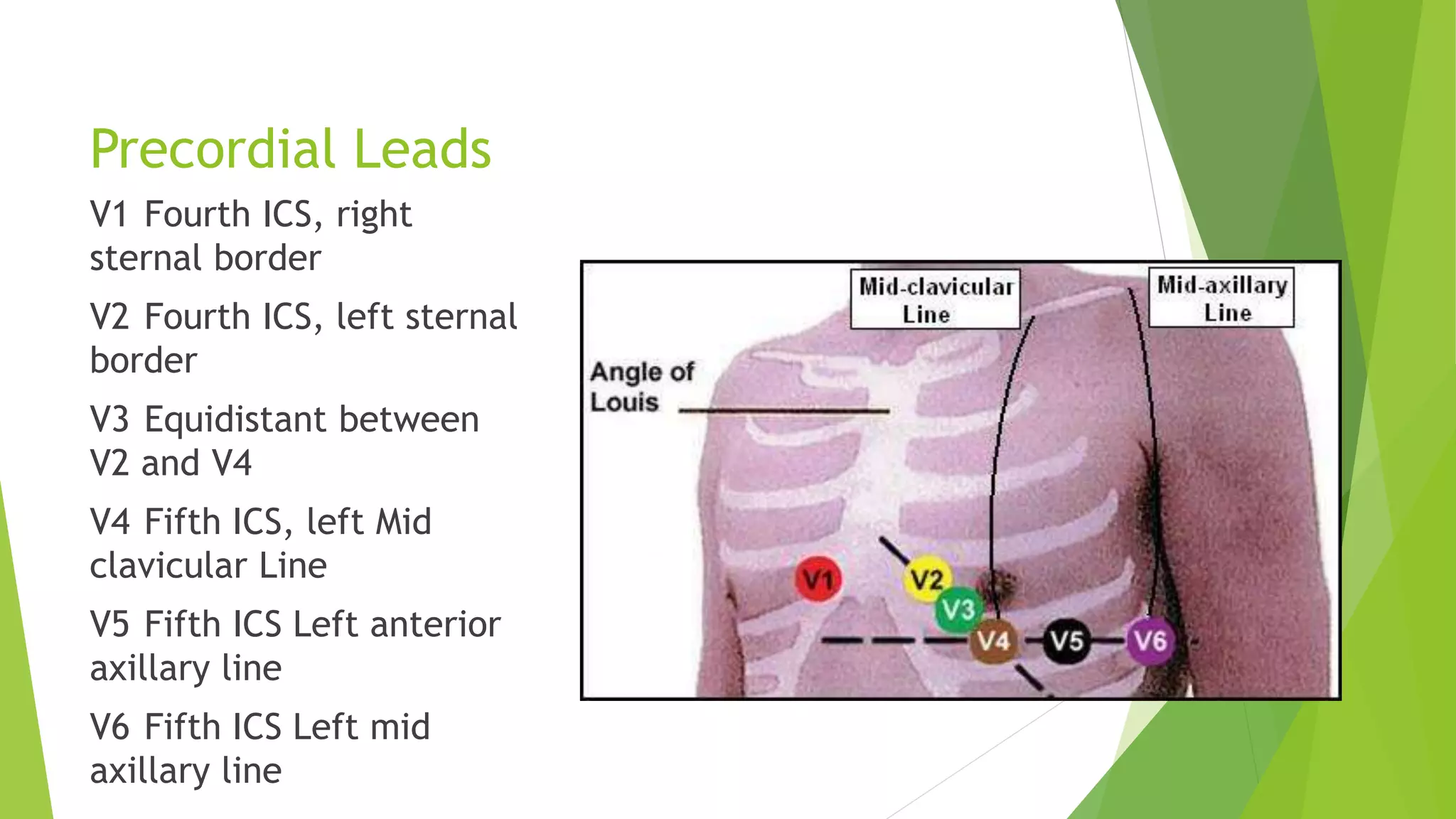 Precordial Leads
V1 Fourth ICS, right
sternal border
V2 Fourth ICS, left sternal
border
V3 Equidistant between
V2 and V4
V4 Fifth ICS, left Mid
clavicular Line
V5 Fifth ICS Left anterior
axillary line
V6 Fifth ICS Left mid
axillary line
 