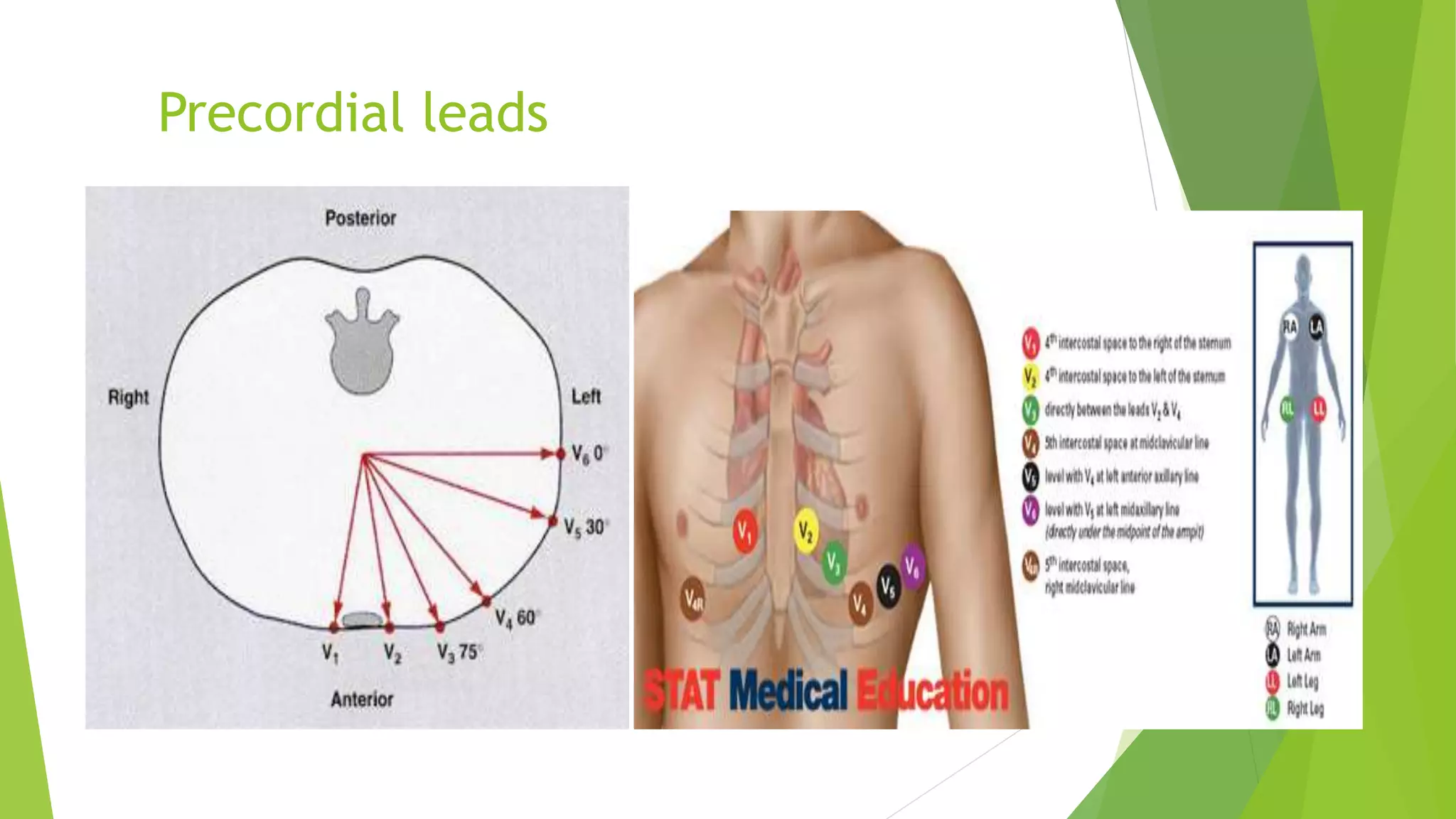 Precordial leads
 