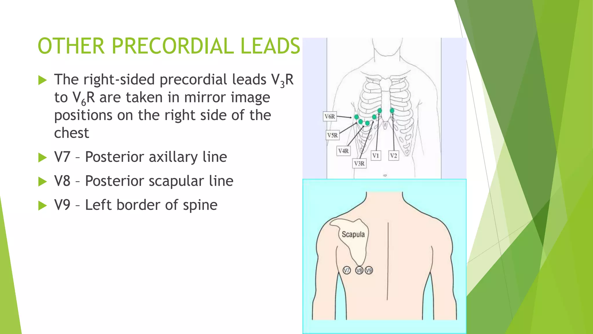 OTHER PRECORDIAL LEADS
 The right-sided precordial leads V3R
to V6R are taken in mirror image
positions on the right side of the
chest
 V7 – Posterior axillary line
 V8 – Posterior scapular line
 V9 – Left border of spine
 