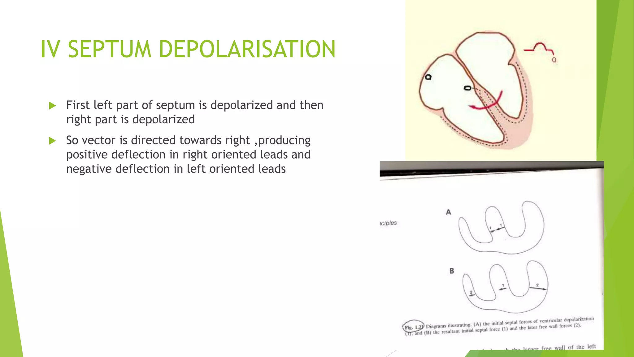 IV SEPTUM DEPOLARISATION
 First left part of septum is depolarized and then
right part is depolarized
 So vector is directed towards right ,producing
positive deflection in right oriented leads and
negative deflection in left oriented leads
 