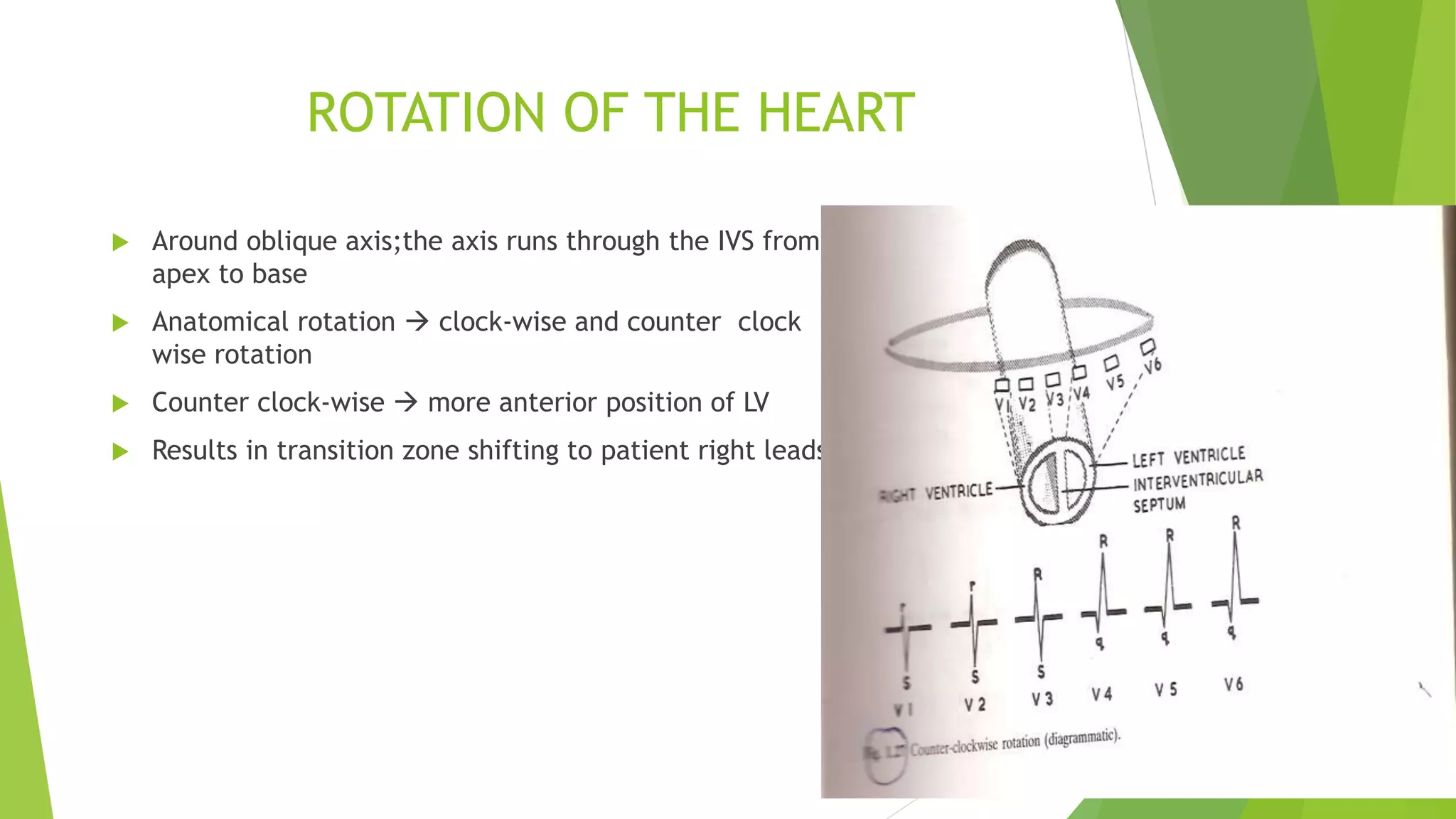 ROTATION OF THE HEART
 Around oblique axis;the axis runs through the IVS from
apex to base
 Anatomical rotation  clock-wise and counter clock
wise rotation
 Counter clock-wise  more anterior position of LV
 Results in transition zone shifting to patient right leads
 