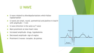 U Box Wave Introduction to ECG | PPTX
